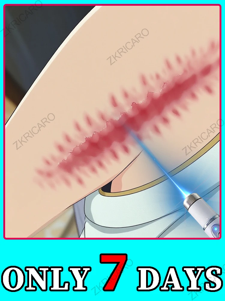 Reparar rapidamente a pele, ferramenta de cuidados com as cicatrizes mais vendida.