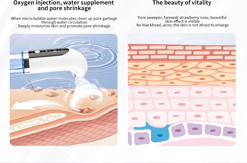 New Arrival 2025 Hot Sell Small Bubble Blackhead Remover Cleaner Water Cycle Blackhead Electric Vacuum Blackhead Remover