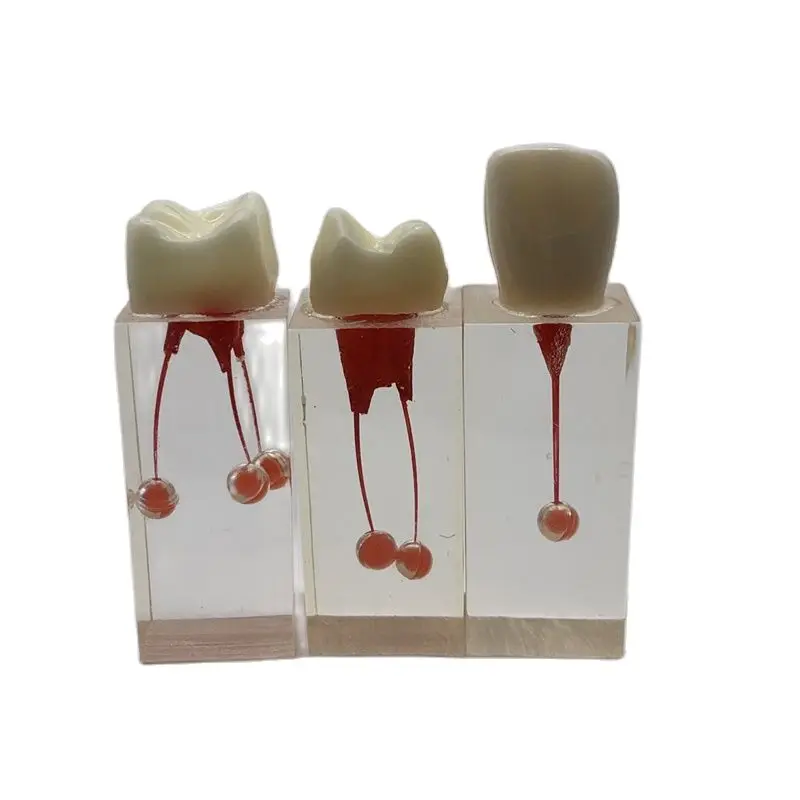 5packs Dental Implant Model Endo Training Block Root Canal Models