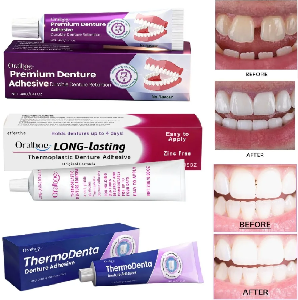 

Comfort Denture Adhesives Glue Teeth Care Thermoplastic Denture Silicone Reline Kit Adhesive Cushion Friction Fixed Dentures