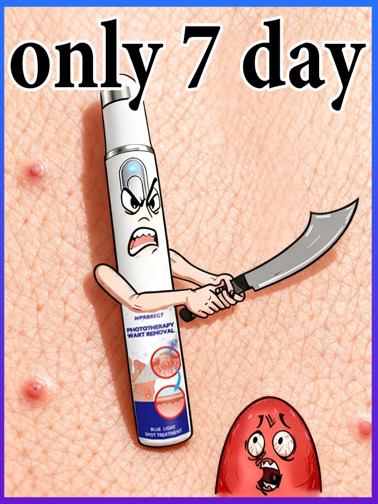 ʙʟᴜᴇ ʟɪɢʜᴛ ᴘᴇɴ sᴏʟᴠᴇ ᴡᴀʀᴛs, ʜᴏᴛ sᴀʟᴇ ᴡᴀʀᴛ ᴄᴀʀᴇ ᴛᴏᴏʟs