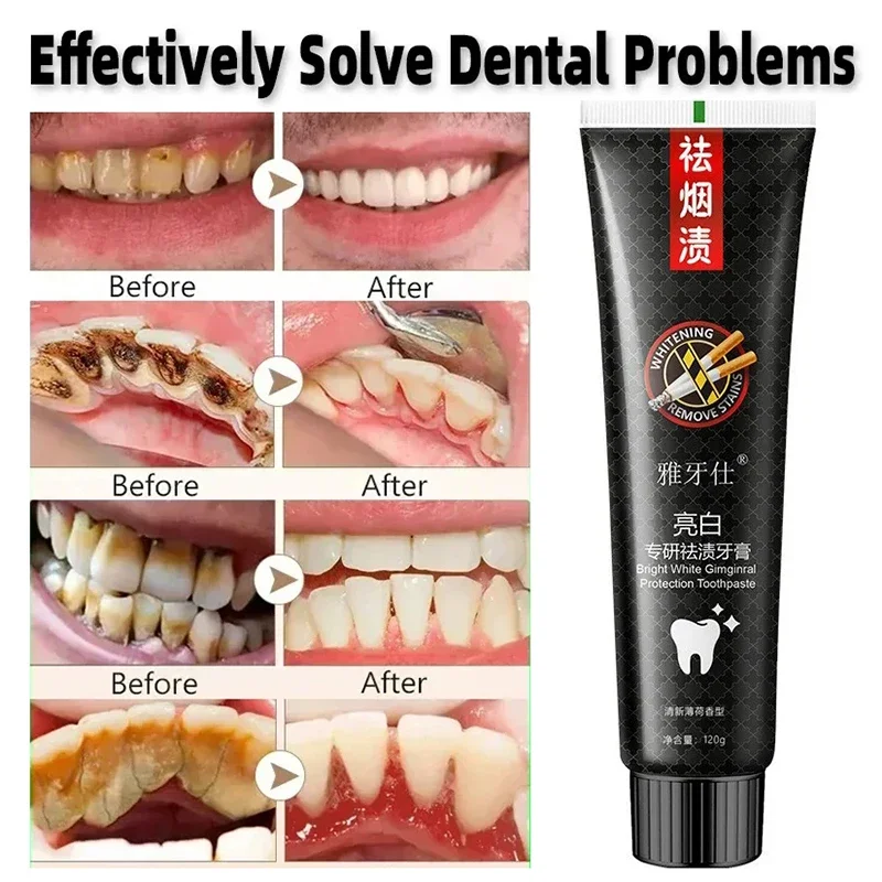 Fast Remove Smoke Stains Toothpaste Remove Plaque Stains Oral Hygiene Cleaning Fresh Breath Teeth Whitening Strips Dental Tools