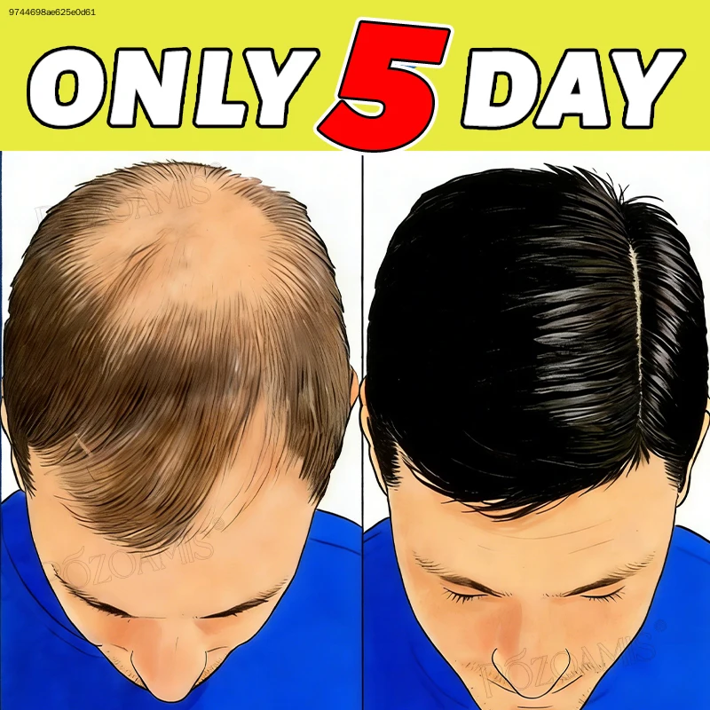 Multi-effect absorption. Creates your ideal hairstyle. Deeply penetrates the scalp, restores confidence, 100% effective.