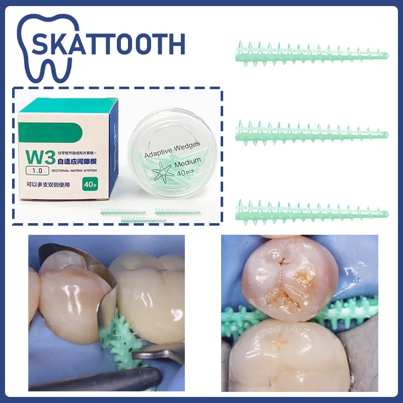 

Стоматологическая матричная система, транссекционная профильная матрица W3, 40 шт., силиконовый эластичный клин, адаптивный клин, стоматологический материал