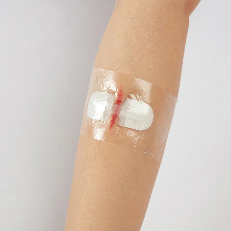 Acne Marks Solutions Sterile Strips, Surgical Grade Adhesive First Aid Travel Kit