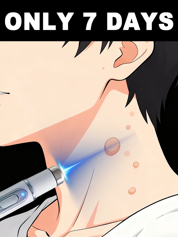 ستجف الثآليل خلال 3 أيام وتسقط بشكل طبيعي في حوالي أسبوع ee #1