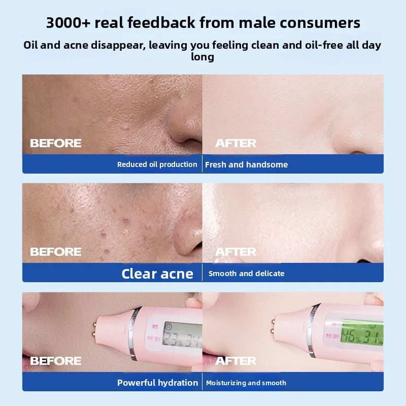 RUYI مجموعة العناية بالبشرة للرجال حمض الساليسيليك الترطيب التحكم النفط ترطيب الحبر غسول إزالة حب الشباب تقليص المسام للرجال العناية بالبشرة #6