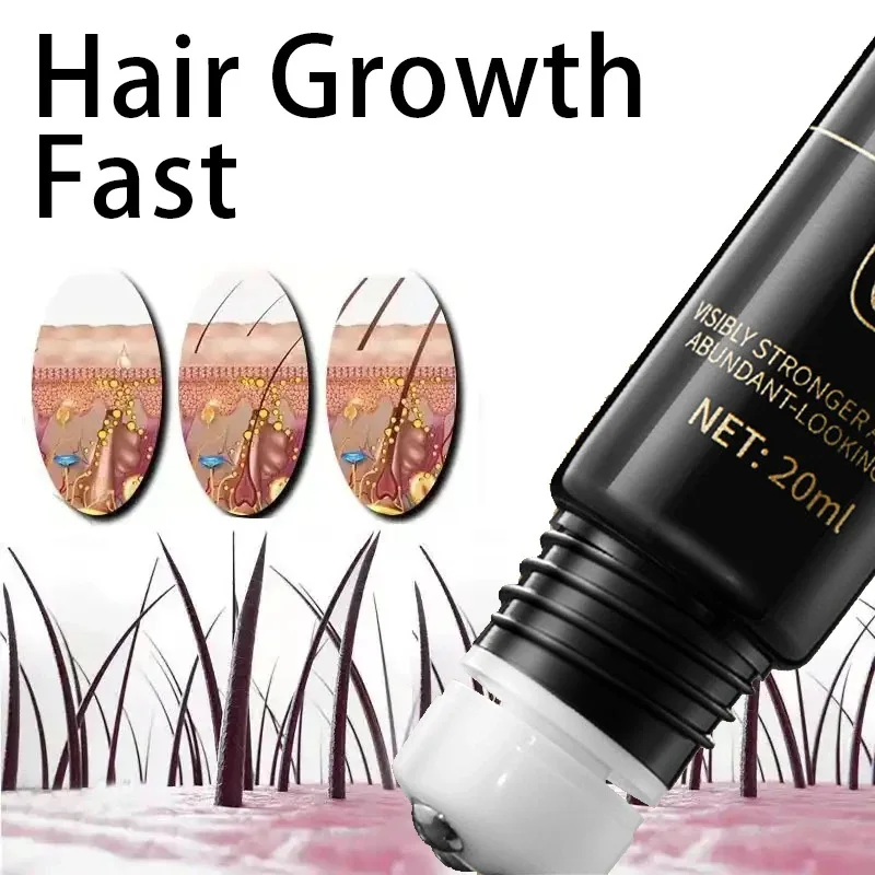 

Biotin fast Hair Growth oil Products Care Scalp Massage Treatments Anti Hair Loss Effective Grow Thicker Hair serum for men