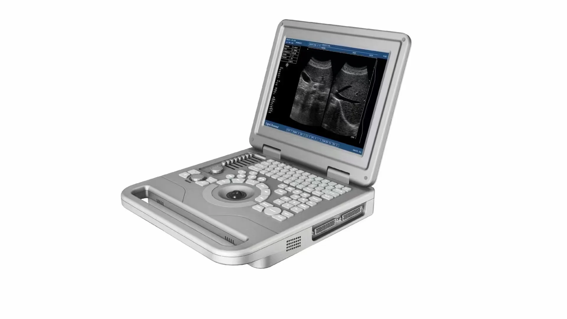 

Vet Ultrasound Portable veterinary Ultrasound machine price