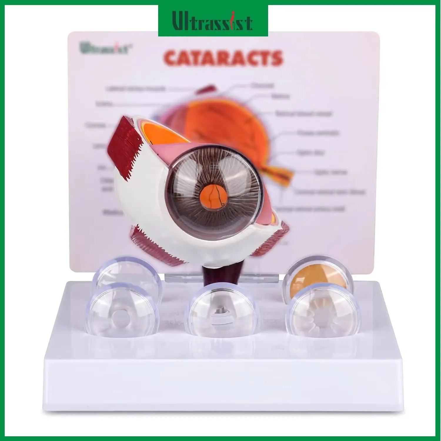 Ultrassist Human Cataract Eye Model Cross-sectional Eye Model with Various Types of Cataract Conditions for Medical Education