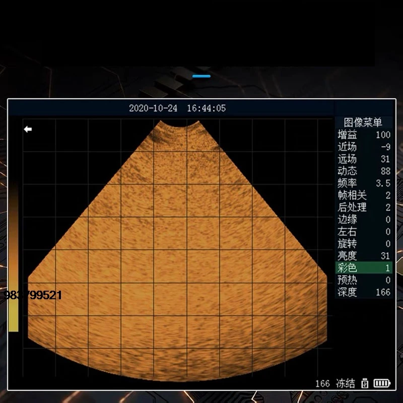 

Good Price NEW Portable Veterinary Ultrasound Machine Mechanical Fan Scan Ultrasound Diagnostic Instrument, High Configur