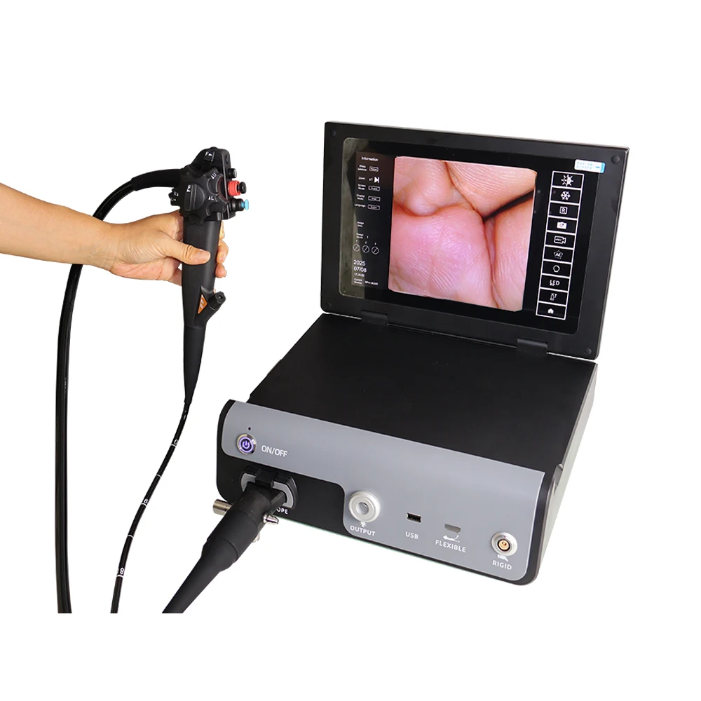 Gastroscopio veterinario portátil de alta definición para endoscopia gastrointestinal superior