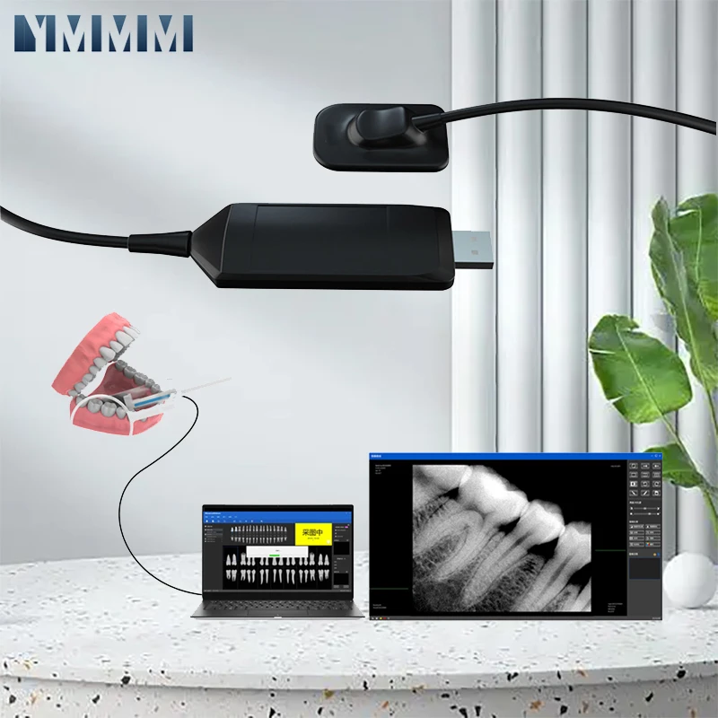 Dentistry Dental Supplies Sensor X-Ray High-Frequency Rx Digital Intraoral Digital System H D Image Radiovisografo Tools