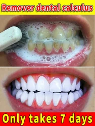 Solve all dental problems