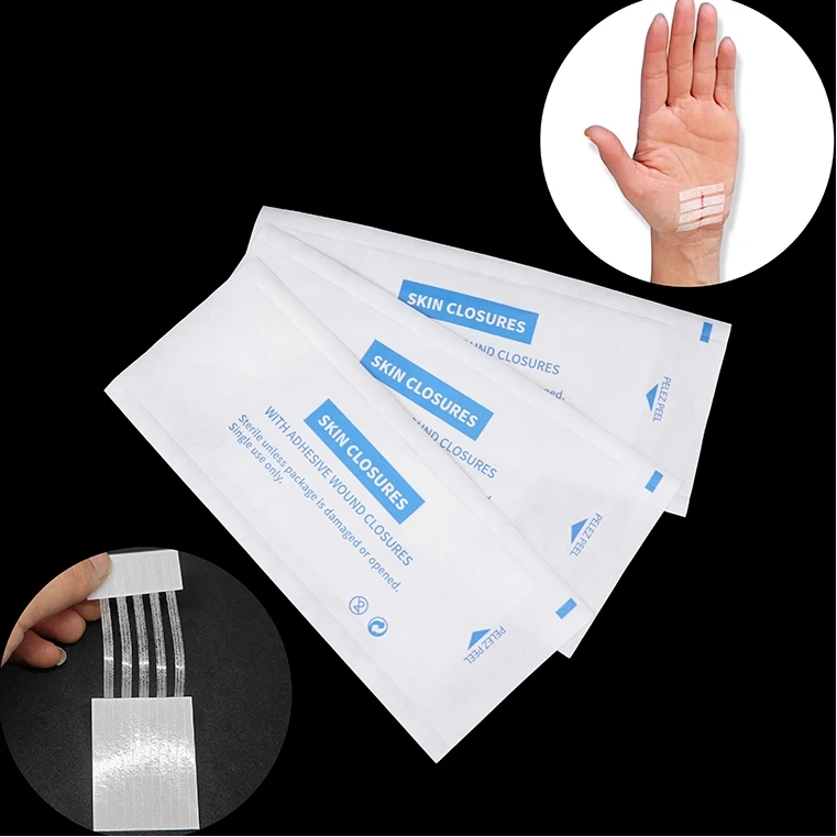 شريط معقم ندبة بعيدا حب الشباب ندبة علامات مزيل المعقمة الإسعافات الأولية السفر الجرح إغلاق الجلد لاصق جراحي طبي