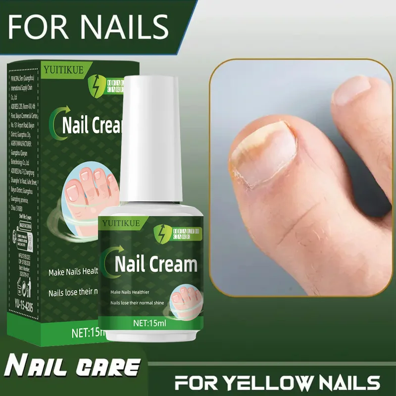 YUITIKUE Nail Repair Cream 15ml - Intensive Repair for Yellow & Dull Nails, Restores Healthy Glow, Day & Night Care