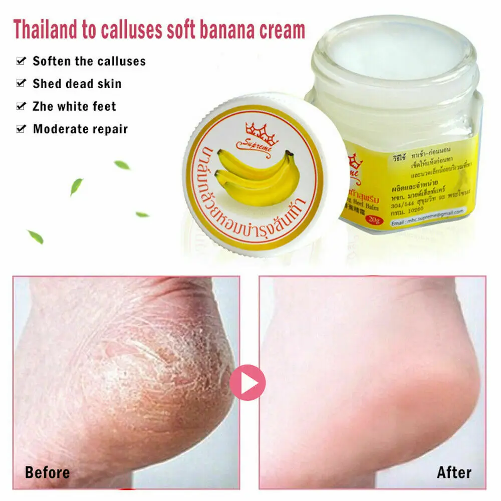 Natural Banana Peel Plant Extract Crack Repair Cream Oil Accelerate Cell Growth Moisturizing Heeling Dry Feet Hands Ankles