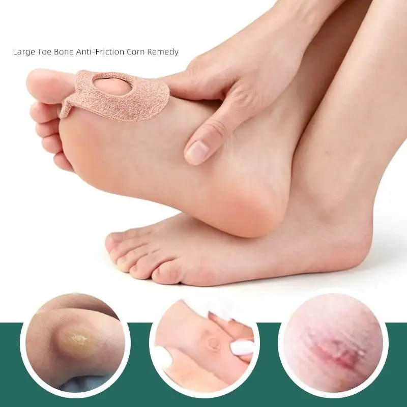 1/50Pcs Hallux Valgus Felt Callus Cushions Bottom of Foot Callus Pads Feet Felt Callus Corn Patches Foot Callous Pain Protector