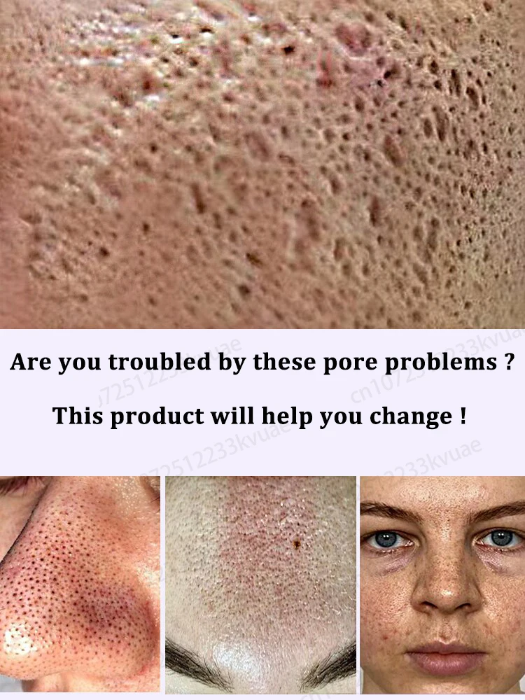 Shrink pore essence, remove dirt from pores and restore smooth skin