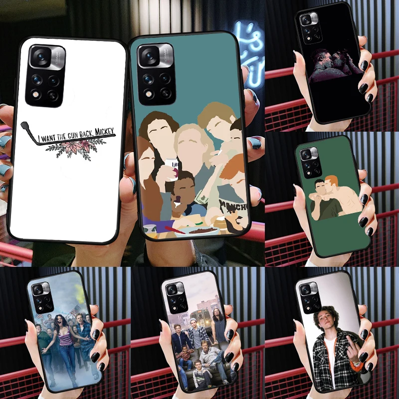 Lip Gallagher Shame… - image