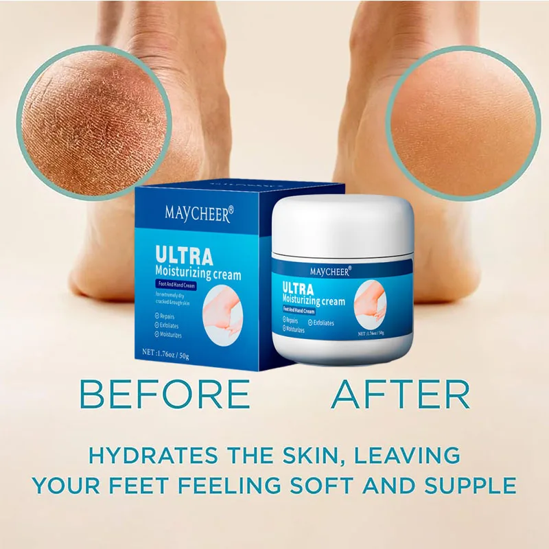 

Herbal Anti Crack Foot Cream Heel Cracking Repair Products Exfoliation Dead Skin Removal Softening Moisturize Smooth Skin Care