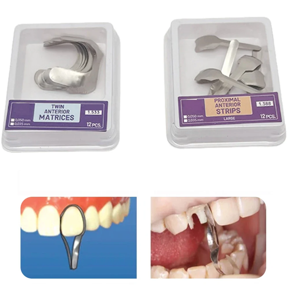 

Dental Proximal Anterior Strips Stainless Steel Dental Matrix Bands Twin Anterior Matrices Matrix Systems Restoration Materials