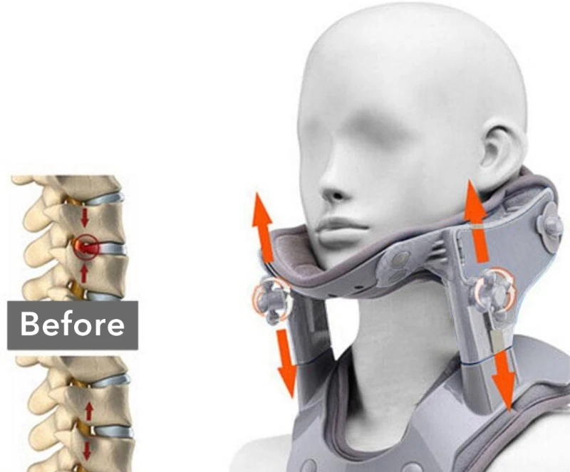 New Electric Heating Cervical Retractor, Hot Compress Physiotherapy Adjustable Support Correction Cervical Spine Fixator