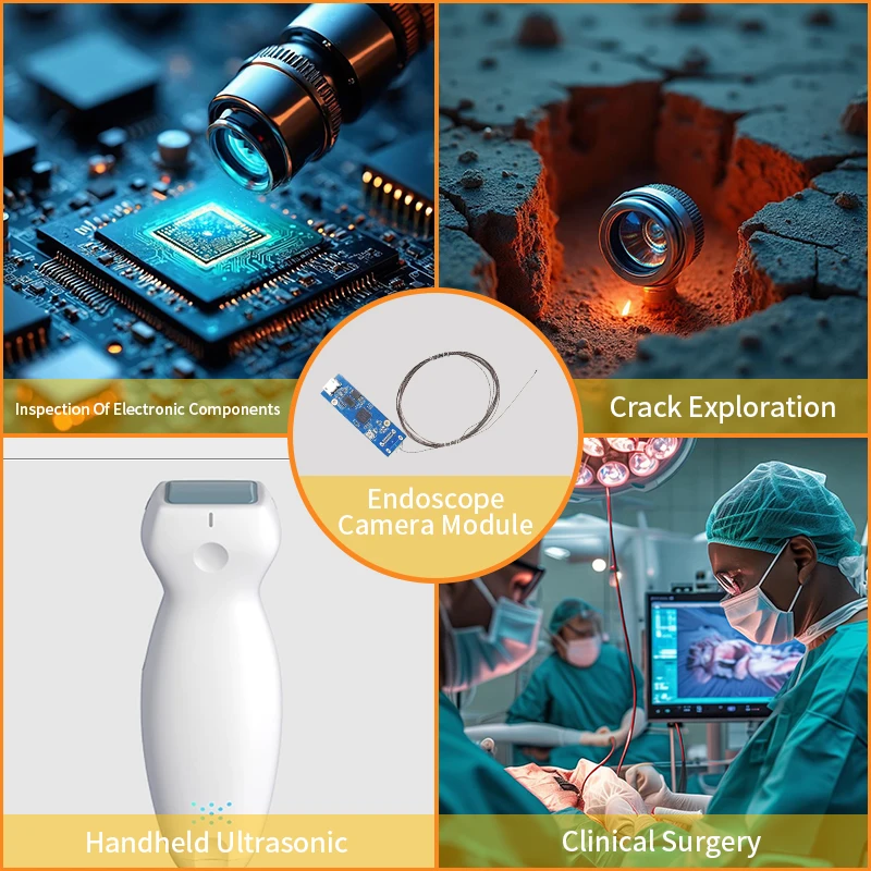 

NEW Smallest 0.9mm Usb Endoscopy Camera Module 400*400 Mini OCHTA10 Endoscope Module Camera for Smart Medical Solutions