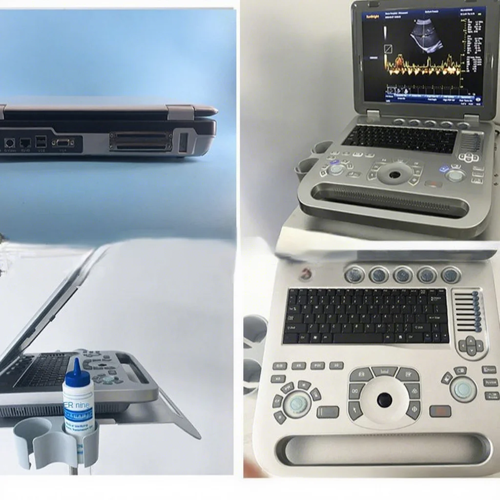 Factory low price Veterinary Ultrasound Machine Fetal Heart Animal Portable Metal Plug-In Wholesale CE Certified SUN-906A