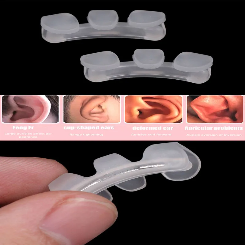 1/2Pcs Baby Auricle Support External Auricle Corrector Protruding Baby Ear Corrector Baby External Auricle Corrector Ear Pads