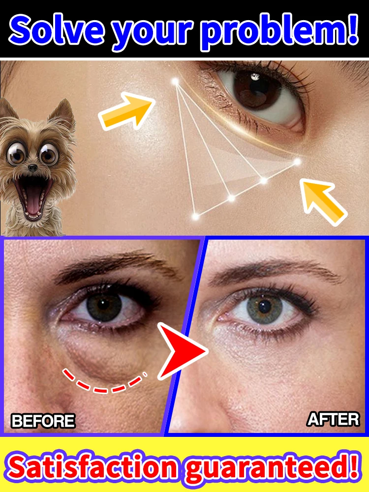 

over 90% buyer choose Eye Cream Collagen Fade Fine Lines Wrinkle Lightening Dark Circles Firming Eye Bags Puffiness Moisturizing