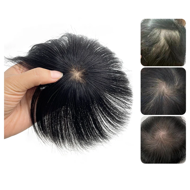 Peruca masculina de cabelo humano, peruca suíça, peças de renda, natural, respirável, desbaste, cobertura de cabelo, testa, calvície