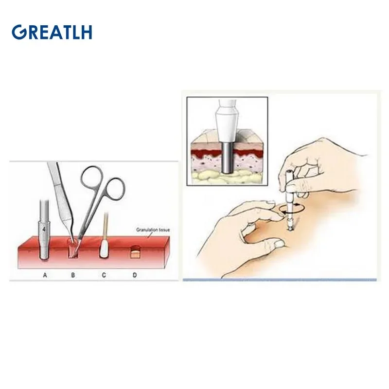 Biopsy Dermal Punch Body Skin Piercing Herramientas de perforación de acero inoxidable