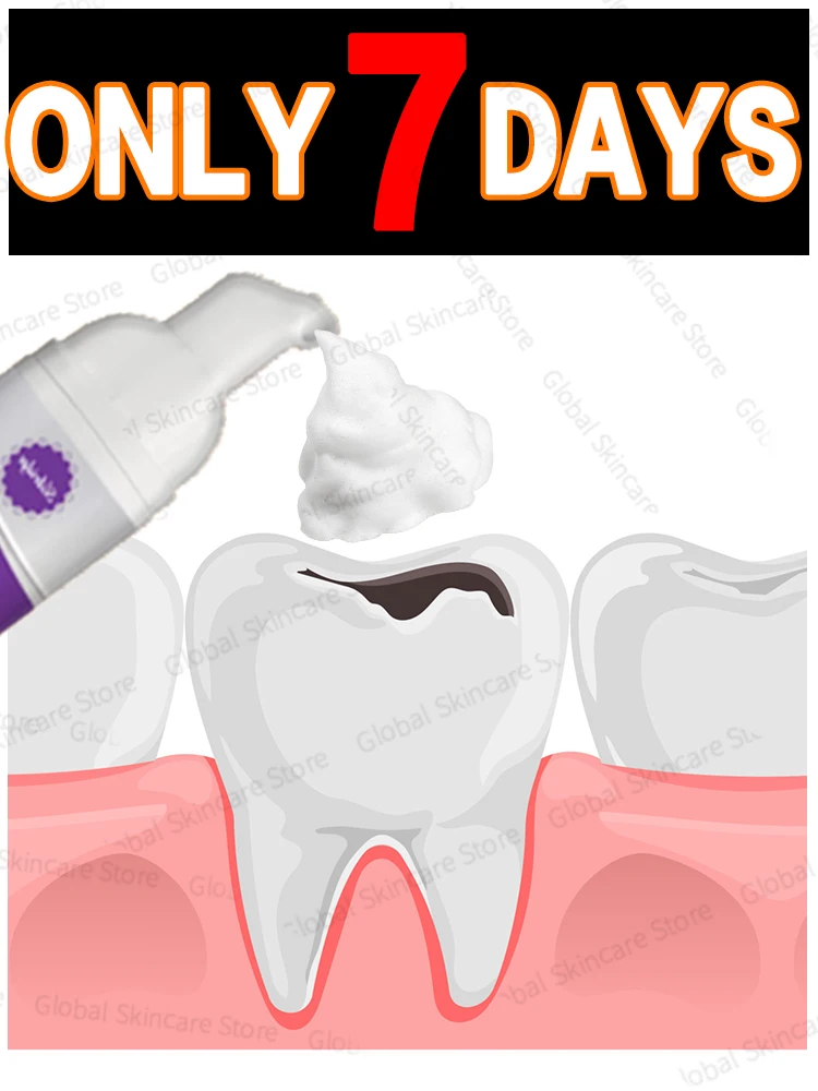 

2025 Oral Care Tools for Correcting Discolored and Damaged Inlays