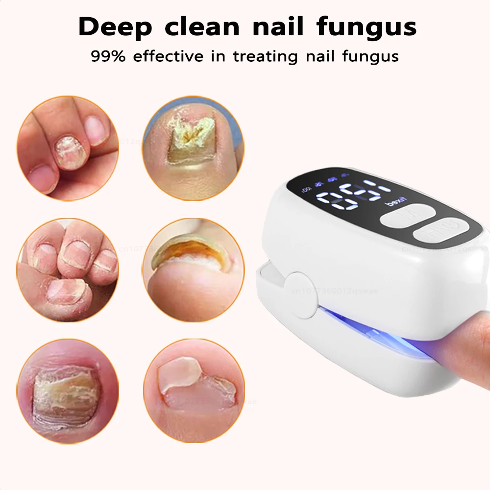 جهاز فطريات الأظافر بالليزر لأظافر القدم المتعددة أظافر فطار الأظافر إصلاح الأظافر معدات ليزر مضادة للفطريات