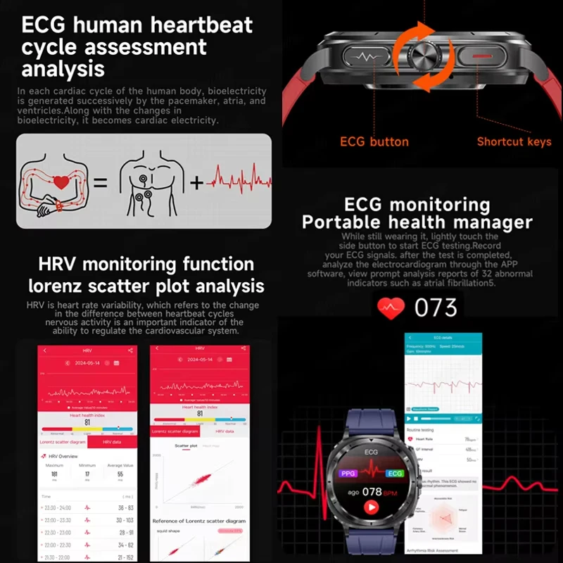 2026 Fashion New Expert level Health ECG+PPG Laser Monitor Uric Acid Smart Watch Men Blood Fat Blood Pressure NFC HD Call Watch