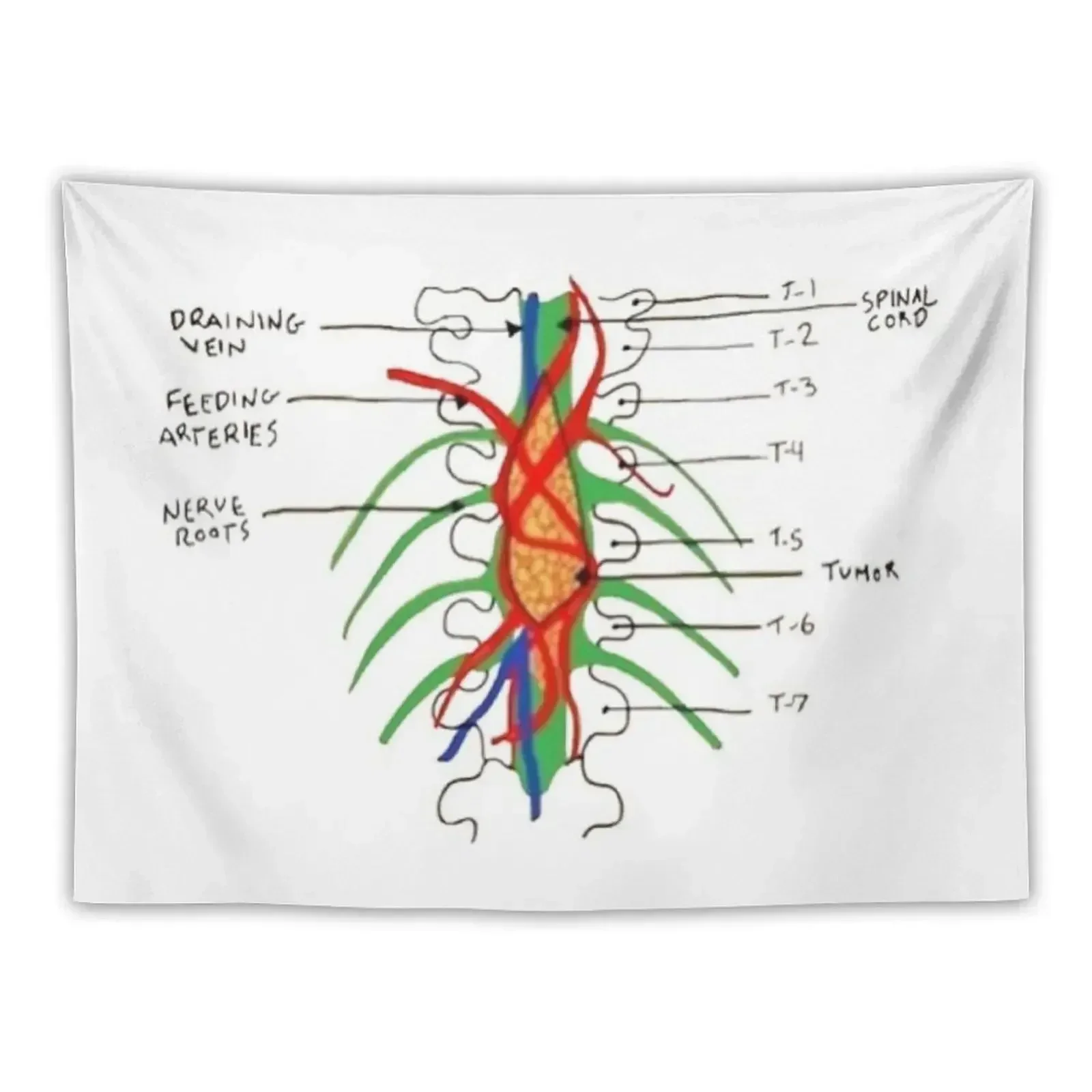 

Greys - Spinal tumour Tapestry Wall Carpet Decorative Wall Bedroom Decoration Tapestry