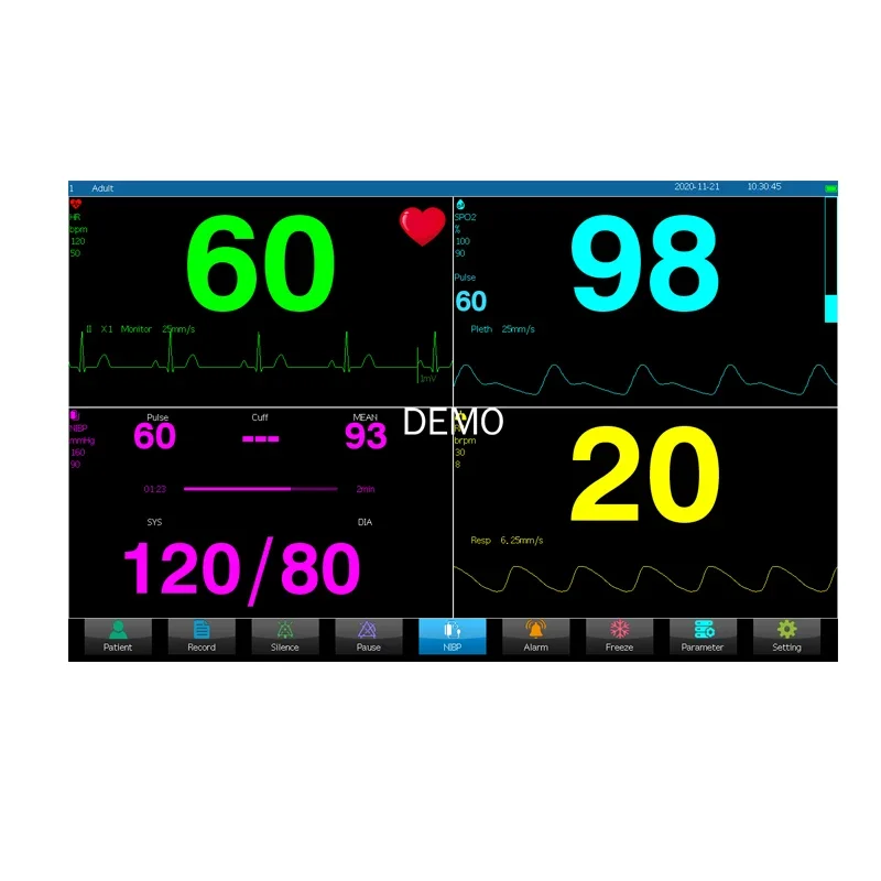 10 inch Full touch screen Human/Vet use portable 6-parameter ECG/NIBP/PR/SPO2/RESP/TEMP patient monitor vital signs monitor