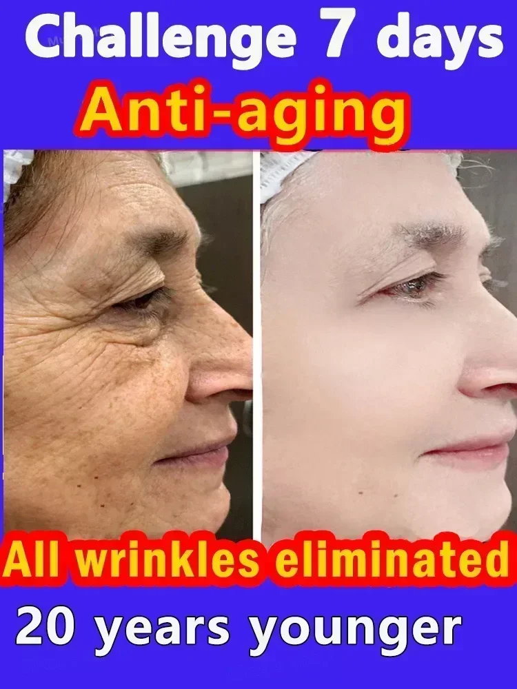 Effective anti-ageing anti-wrinkle facial serum to remove facial wrinkles fine lines around the eyes crow's feet neck wrinkl