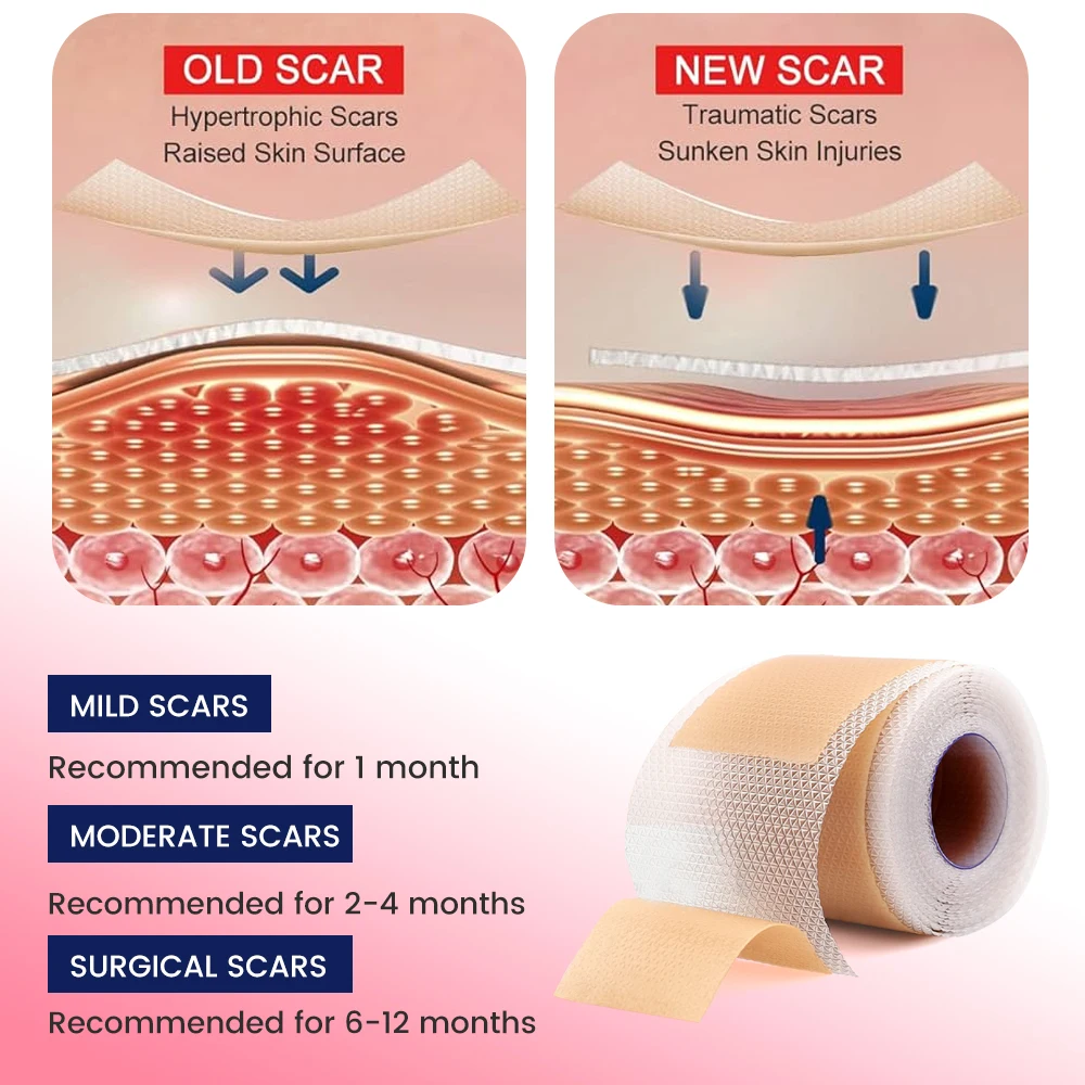 1Roll/Pack (1roll=4cm*150cm) Silicone Scar Sheets Painless Scar Repair Tape Roll Scar Removal Strips Face Body Acne Skin Care