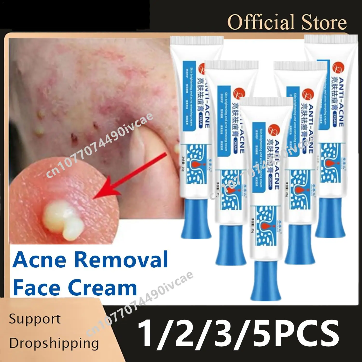 1/3/5 pçs remoção de acne creme facial natural acne beleza saúde anti-acne gel espinha remoção de manchas rosto cuidados com a pele suave sem estimulação