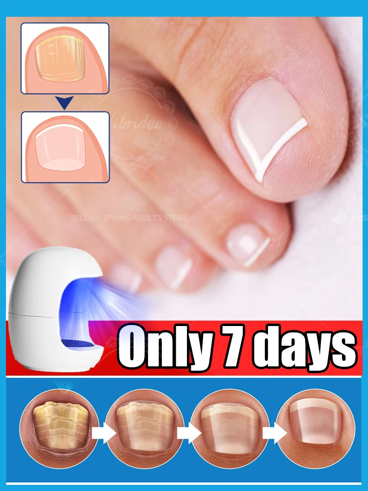 

manicure for bad Can in 7 days farewell
