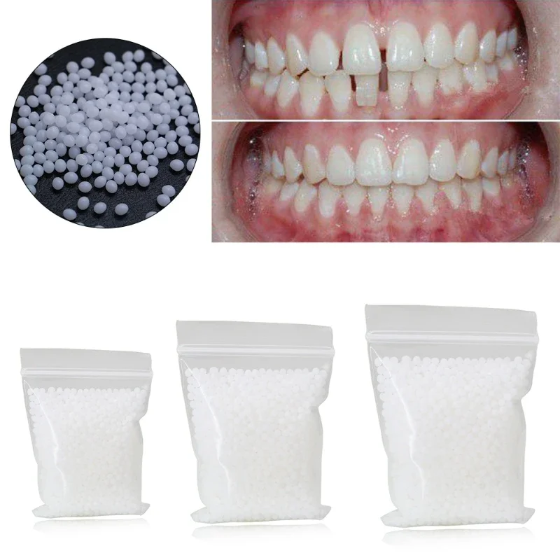 Sdotter New Teeth Repair Kit,Temporary Teeth Replacement Kit,Do it Yourself Thermal Fitting Beads, Moldable False Teeth for On D