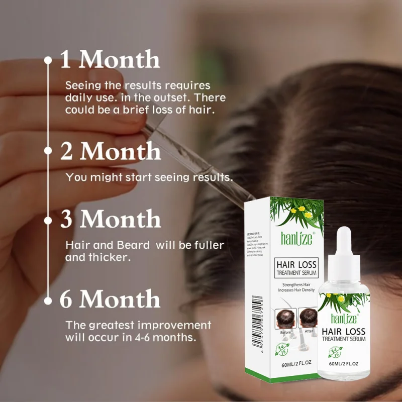 

Сыворотка для восстановления волосScalp Уход за волосами 5%Mino Essence Питательные палочки для волос Трансграничная эксклюзивная поставка