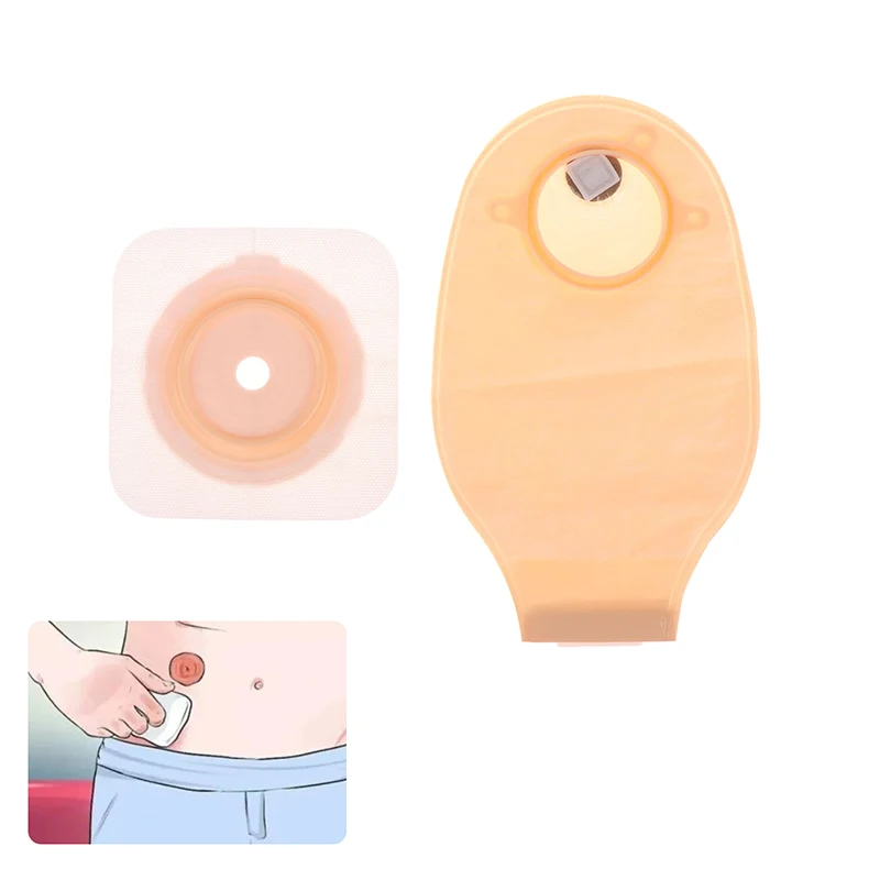 Ostomy Supplies Colostomy Bags Two Piece Drainable Pouches Ileostomy Stoma Care Prevent Leakage