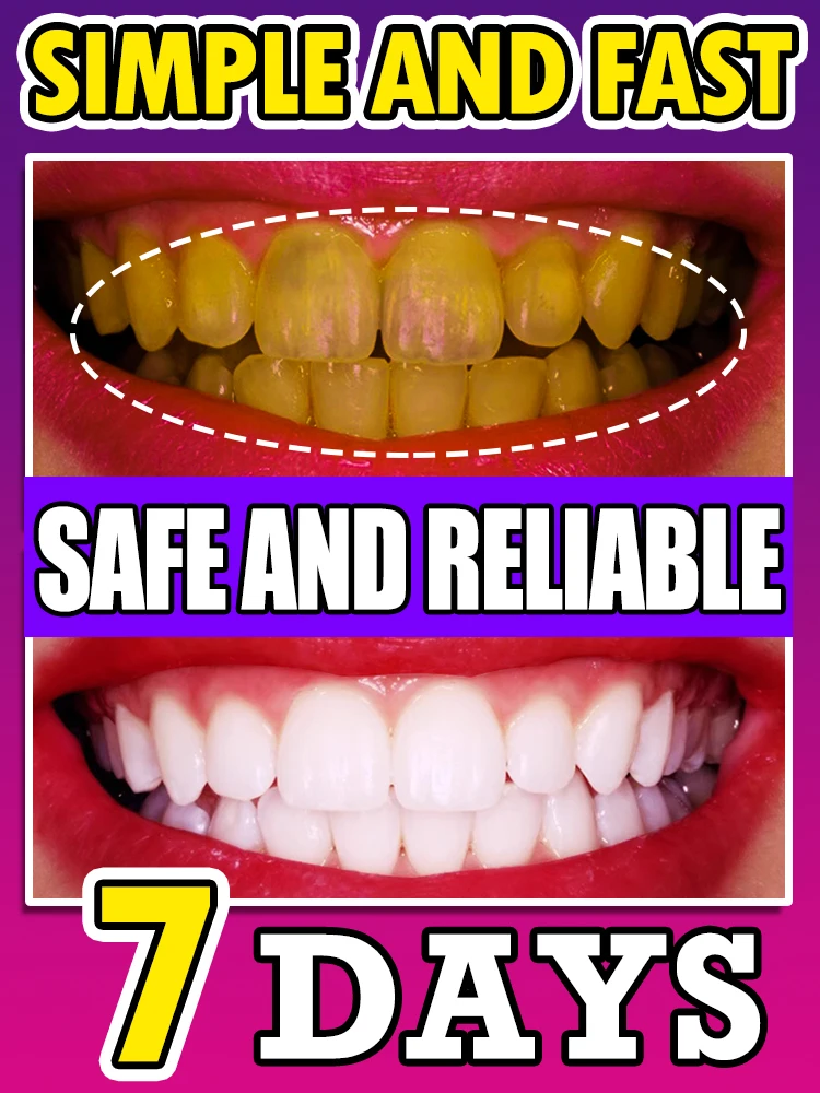 

Tartar removal, pay attention to dental health, huge discount, family pack
