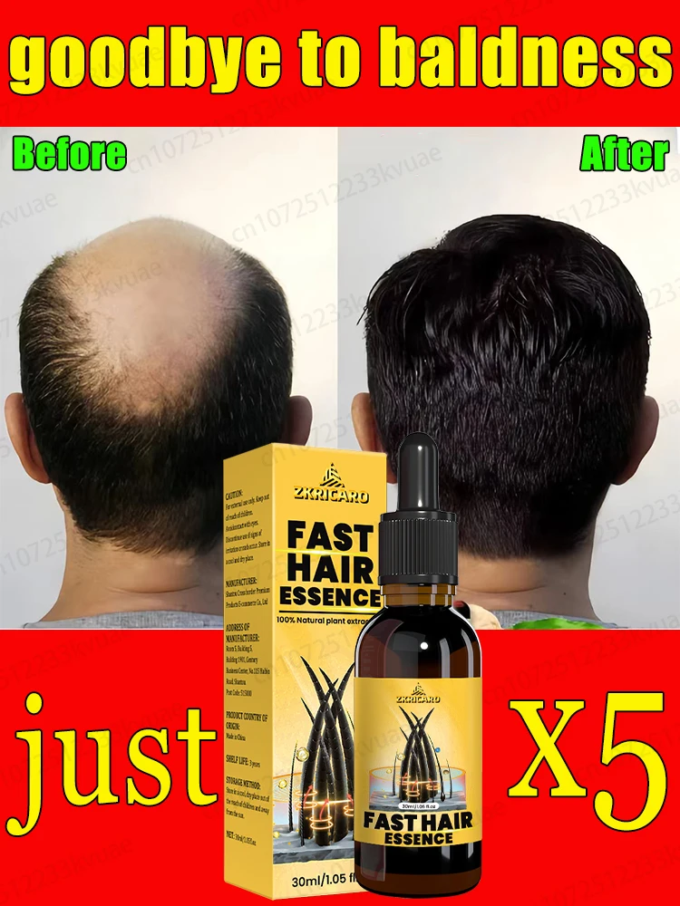 

WPRBREGT hair growth essential oil, effective in repairing baldness and hair loss, even at the age of 80