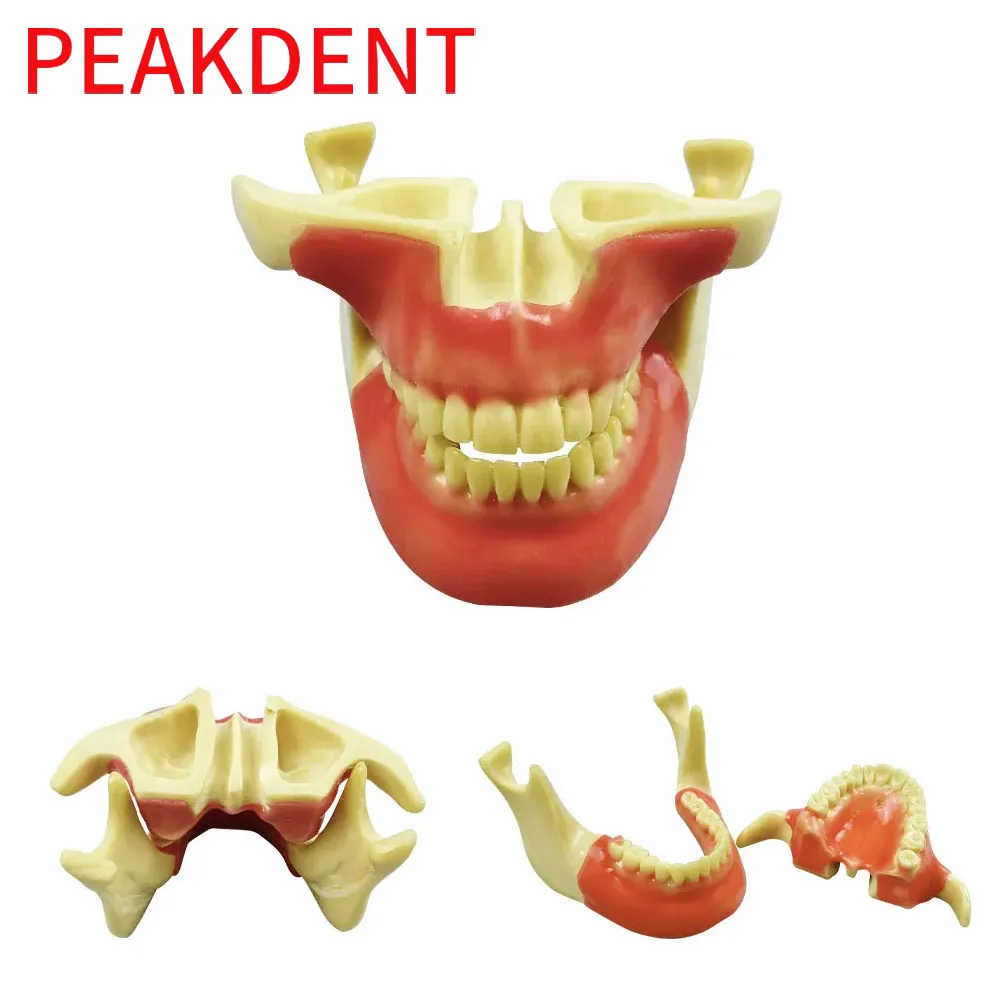 Dental Jaw Model Removable Soft Gum with Anatomical Bone Structure Full Mouth Teeth for Surgical Training Student Education