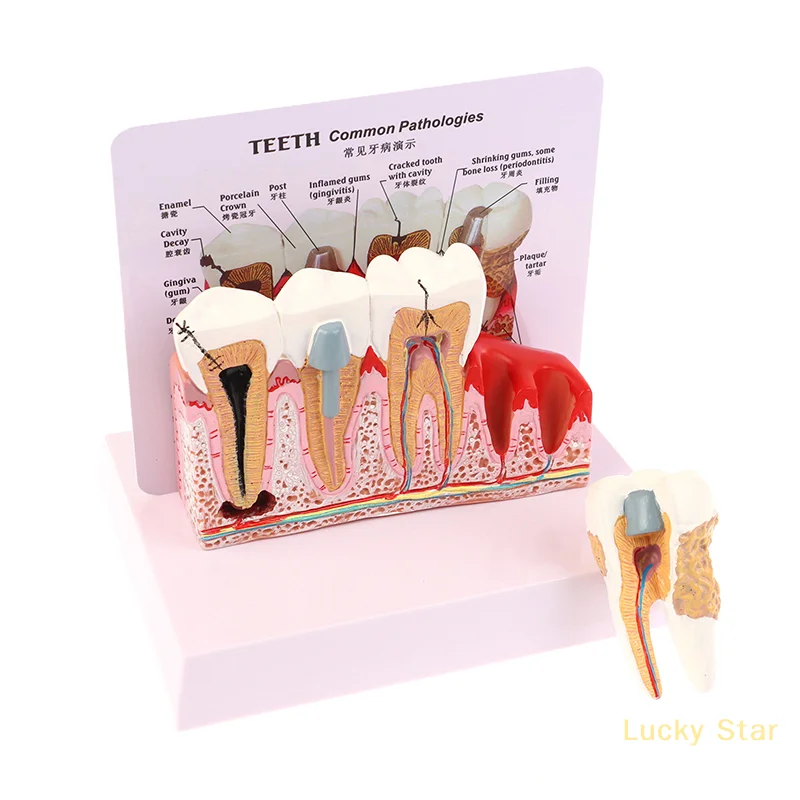 Standard Dental Oral Teeth Anatomical Teaching Model Comprehensive Tooth Structure Model Dentist Dental Student Demonstration