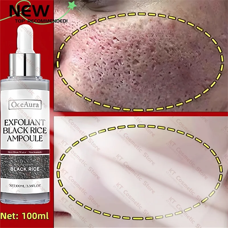 

Black Rice Exfoliating Serum Remove Large Pores Oil Control Deep Cleaning Blackhead Brighten Moisturize Rough Dull Face Skincare